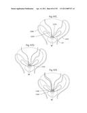 APPARATUS FOR CONTROLLING FLOW IN A BODILY ORGAN diagram and image