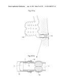 APPARATUS FOR CONTROLLING FLOW IN A BODILY ORGAN diagram and image