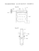 APPARATUS FOR CONTROLLING FLOW IN A BODILY ORGAN diagram and image