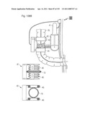 APPARATUS FOR CONTROLLING FLOW IN A BODILY ORGAN diagram and image