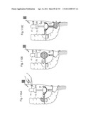 APPARATUS FOR CONTROLLING FLOW IN A BODILY ORGAN diagram and image