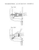 APPARATUS FOR CONTROLLING FLOW IN A BODILY ORGAN diagram and image