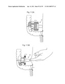 APPARATUS FOR CONTROLLING FLOW IN A BODILY ORGAN diagram and image