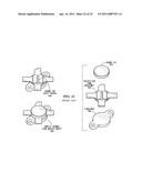 MODULAR LOW STRESS PACKAGE TECHNOLOGY diagram and image