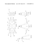 ROBOT MILKING ARM AND A METHOD OF ATTACHING MILKING CUPS diagram and image