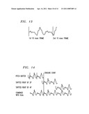 Method and Apparatus for Performing Packet Loss or Frame Erasure Concealment diagram and image