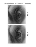 COMPOSITION AND METHODS FOR PROMOTING LUSH HAIR GROWTH diagram and image