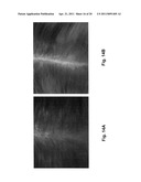 COMPOSITION AND METHODS FOR PROMOTING LUSH HAIR GROWTH diagram and image