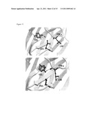 NOVEL ANTIGEN BINDING DIMER-COMPLEXES, METHODS OF MAKING AND USES THEREOF diagram and image