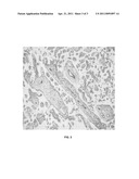 COMPOSITIONS COMPRISING NANOMATERIALS AND METHOD FOR USING SUCH COMPOSITIONS FOR HISTOCHEMICAL PROCESSES diagram and image