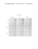 CELL-PERMEABLE ENDOSTATIN RECOMBINANT PROTEIN, A POLYNUCLEOTIDE ENCODING THE SAME, AND AN ANTI-CANCER PREPARATION CONTAINING THE SAME AS AN ACTIVE COMPONENT diagram and image