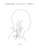 ENERGETIC MODULATION OF NERVES diagram and image