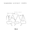 DYNAMIC TRACKING OF MOVING TARGETS diagram and image