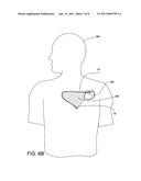 Active implant medical device (AMID) and medical imaging scanner communications involving patient-specific AIMD configuration diagram and image