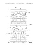 Patient-Specific Pre-Operative Planning diagram and image