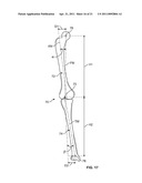 Patient-Specific Pre-Operative Planning diagram and image