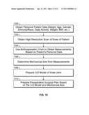 Patient-Specific Pre-Operative Planning diagram and image