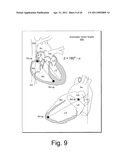 CARDIAC COORDINATE SYSTEM FOR MOTION ANALYSIS diagram and image