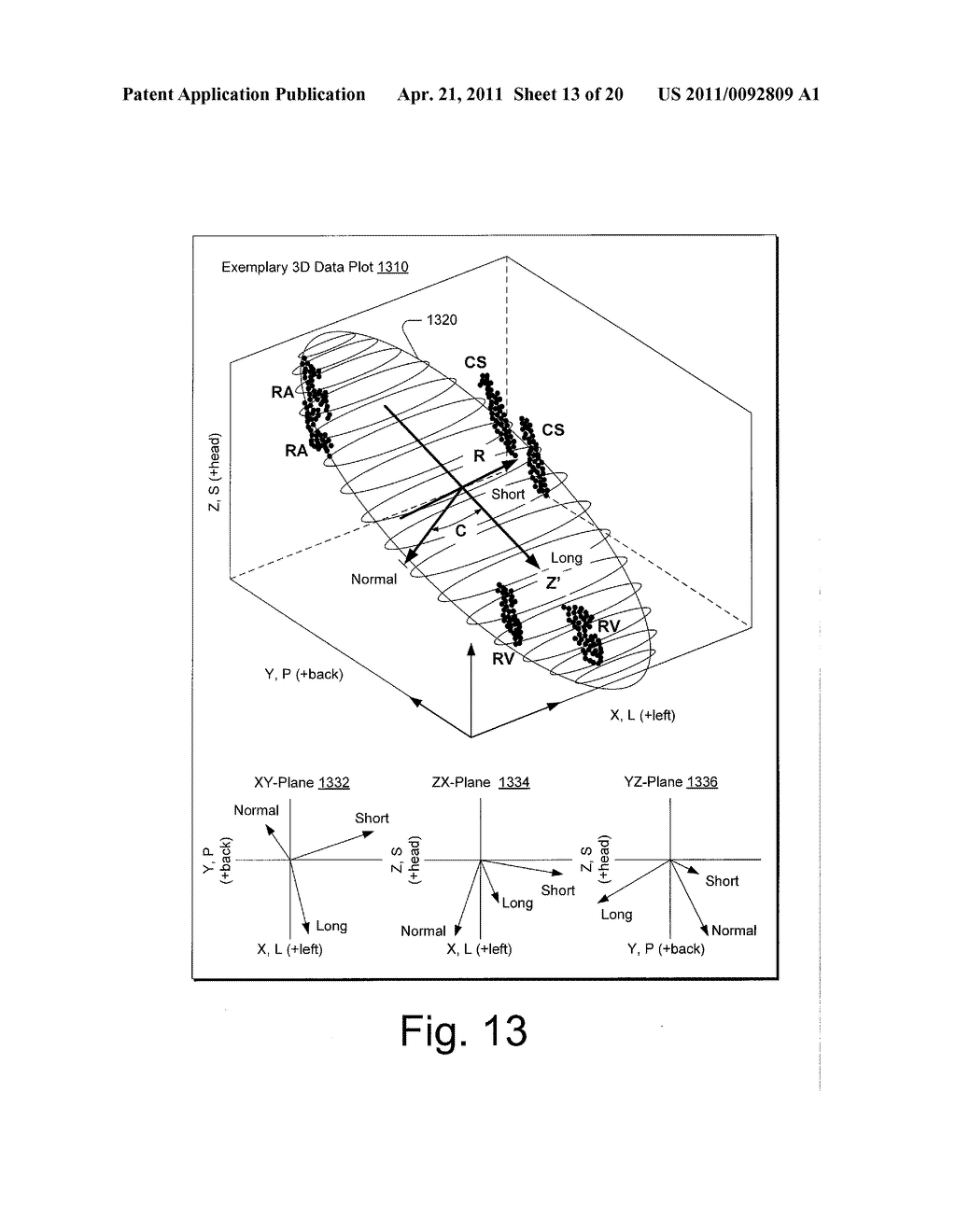 CARDIAC COORDINATE SYSTEM FOR MOTION ANALYSIS - diagram, schematic, and image 14