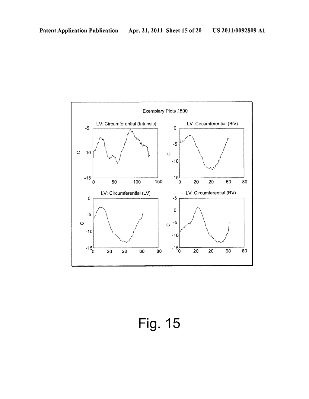 CARDIAC COORDINATE SYSTEM FOR MOTION ANALYSIS - diagram, schematic, and image 16