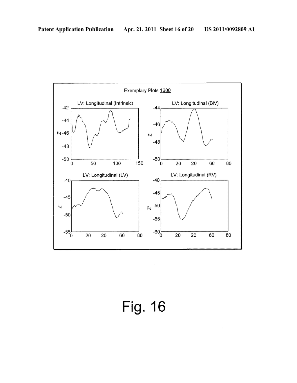 CARDIAC COORDINATE SYSTEM FOR MOTION ANALYSIS - diagram, schematic, and image 17