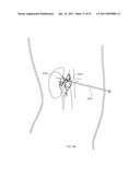 ENERGETIC MODULATION OF NERVES diagram and image