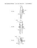 ENERGETIC MODULATION OF NERVES diagram and image