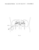 ENERGETIC MODULATION OF NERVES diagram and image