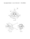 ENERGETIC MODULATION OF NERVES diagram and image