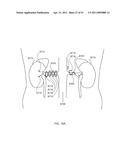 ENERGETIC MODULATION OF NERVES diagram and image