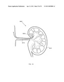 ENERGETIC MODULATION OF NERVES diagram and image