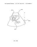 ENERGETIC MODULATION OF NERVES diagram and image