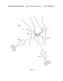 ENERGETIC MODULATION OF NERVES diagram and image