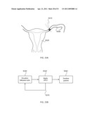 ENERGETIC MODULATION OF NERVES diagram and image