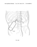 ENERGETIC MODULATION OF NERVES diagram and image