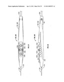 Electrosurgical Pencil with Advanced ES Controls diagram and image