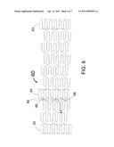 HYBRID STENT WITH HELICAL CONNECTORS diagram and image