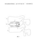 Expandable Fusion Device and Method of Installation Thereof diagram and image