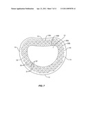 Intervertebral Spacer diagram and image