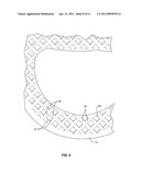 Intervertebral Spacer diagram and image