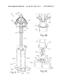 Wall Anchor diagram and image