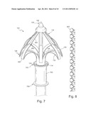 Wall Anchor diagram and image