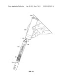 Apparatus and Method for Cleaning Microsurgical Instruments diagram and image