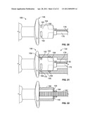 Apparatus and Method for Cleaning Microsurgical Instruments diagram and image