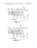 SERIAL SIPHON VALVES FOR FLUIDIC OR MICROFLUIDIC DEVICES diagram and image