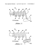 SERIAL SIPHON VALVES FOR FLUIDIC OR MICROFLUIDIC DEVICES diagram and image