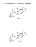 Method For Manufacturing A Balloon Encapsulated Catheter Tip diagram and image
