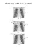 METHOD AND SYSTEM FOR CUSTOMIZING MEDICAL IMAGES BASED ON PATIENT PREFERENCE diagram and image