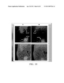 RADIOLABELING METHOD USING MULTIVALENT GLYCOLIGANDS AS HEPATIC RECEPTOR IMAGING AGENT diagram and image