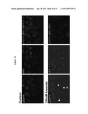 COMPOSITIONS AND METHODS FOR TREATING CANCER AND MODULATING STRESS GRANULE FORMATION diagram and image